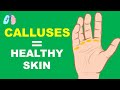 Why do we get calluses?