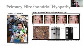MDA Engage: Mitochondrial Myopathy Symposium