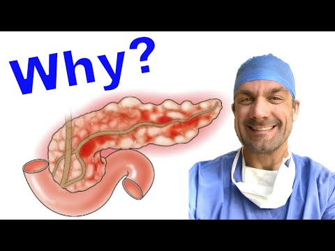 What Causes Acute Pancreatitis and Why?