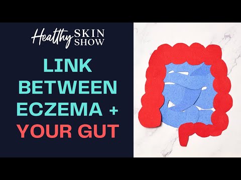 Eczema-Gut CONNECTION | Jennifer Fugo