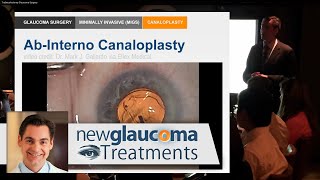 Download Lagu AB Interno Canaloplasty for Glaucoma Thumbnail