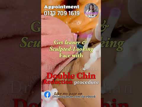 Double Chin Reduction Treatment - Dr. Israt Jahan
