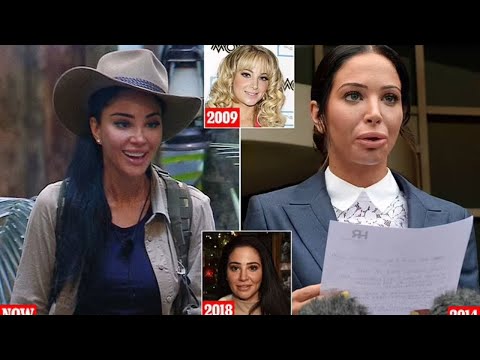 Tulisa's 12-Year Health Battle: How It Changed Her Face Forever
