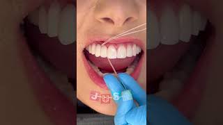 Flossing with a dental bridge 🦷 #dentistry