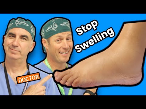 Foot And Ankle Swelling: How To Stop It!