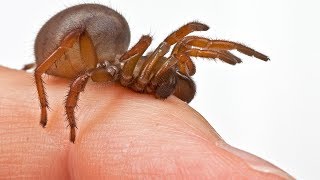 World's Worst Spider Bites