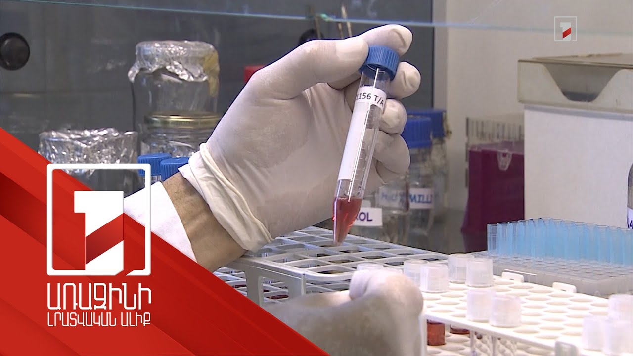 «Կապկի ծաղիկ». համավարակի վտանգ չկա, բայց ստեղծվել է նոր դեղամիջոց