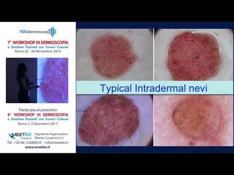 La pigmentazione come esso per togliere da una faccia La crema per il viso che candeggia Evelina