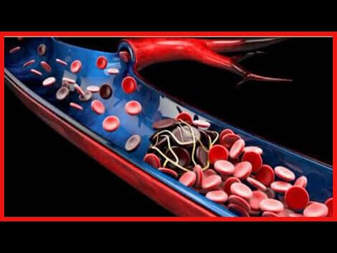 金属微量元素 - 定義