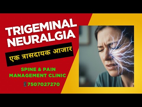 Trigeminal Neuralgia त्रासदायक आजार-माहिती व उपचार | Dr. Uttam Sidhaye