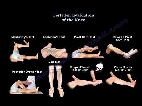 Tests For Examination Of The Knee - Everything You Need To Know - Dr. Nabil Ebraheim