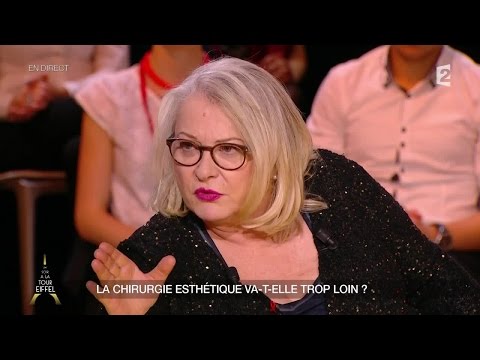 Josiane Balasko parle de sa rhinoplastie