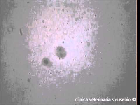 Come controllare vermi al bimbo Che trattare un verme un pinworm al bambino