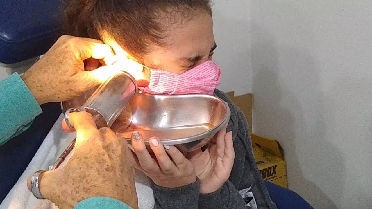 Retirando a Cera de Ouvido com um Jato d'água