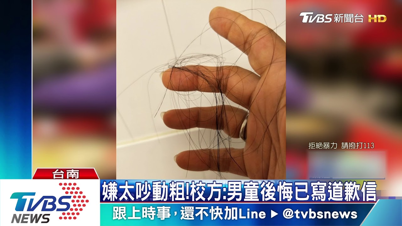 加油聲太大挨揍！　母控同學欺負害掉髮