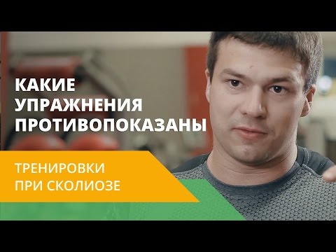 Фиксированный сколиоз 2 степени и армия Лечебная физкультура при сколиозе позвоночника у взрослых
