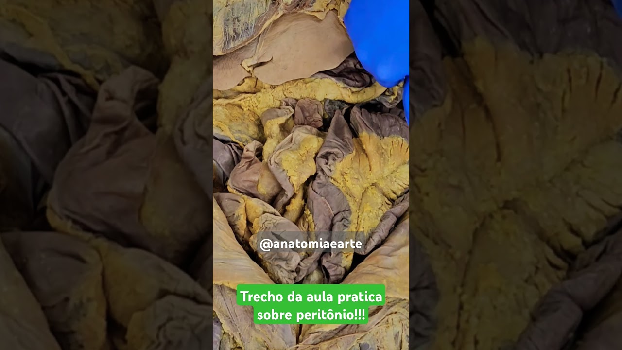 Diferença entre peritônio parietal e visceral #anatomy #anatomiaclinica #medico