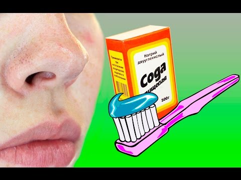 Пигментация кожи у мопса Хороший крем для отбеливания кожи лица