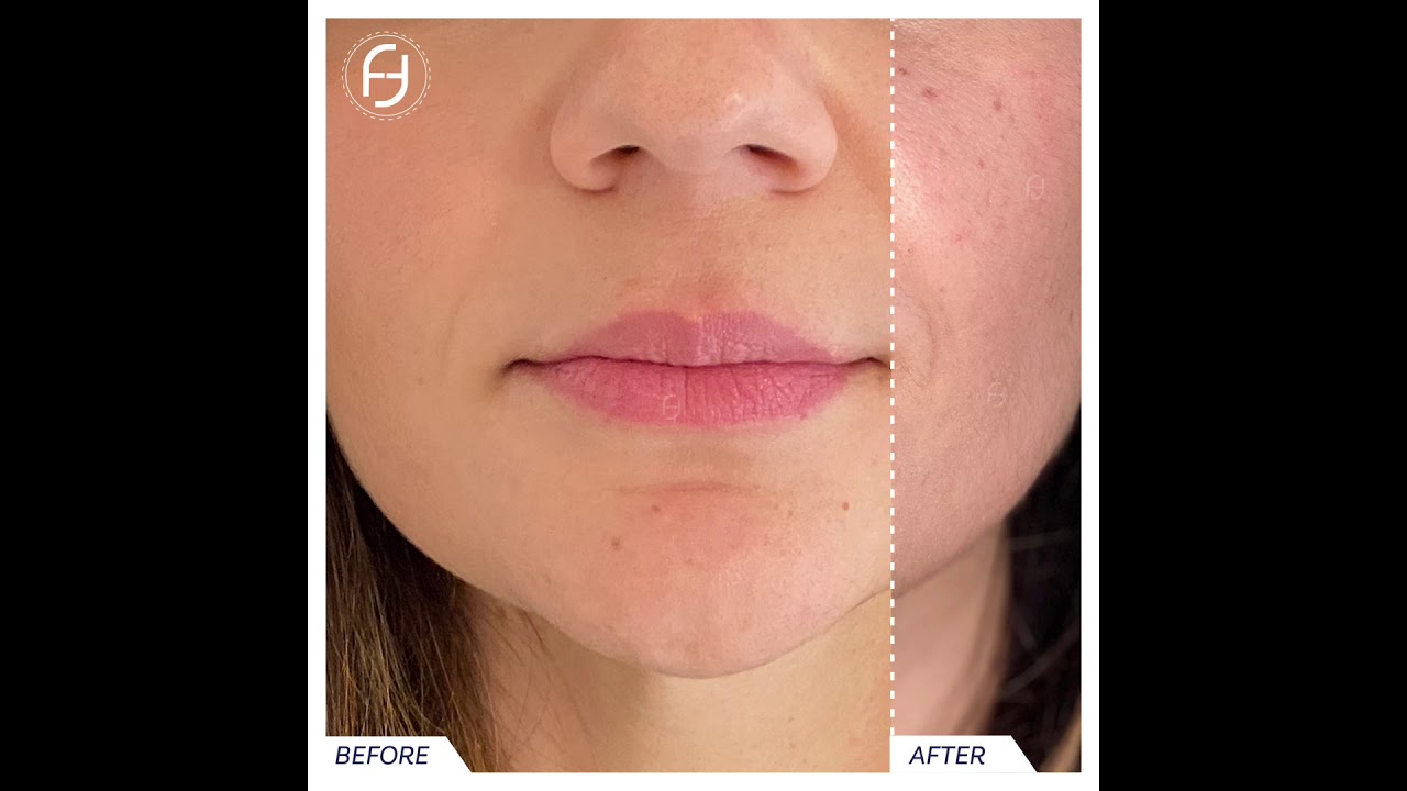 Francesca Flagiello-92