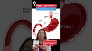 🩺 Cathy Explains: Peptic Ulcer Disease, Gastric vs Duodenal Ulcers MedSurg: SHORT @LevelUpRN