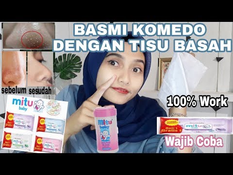 download video viral Cara Menghilangkan Komedo Untuk Kulit Sensitif, download Cara Menghilangkan Komedo Untuk Kulit Sensitif gratis, unduh Cara Menghilangkan Komedo Untuk Kulit Sensitif