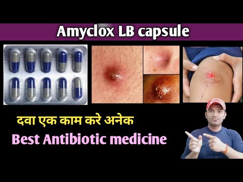 Amoxicillin Cloxacillin Capsules