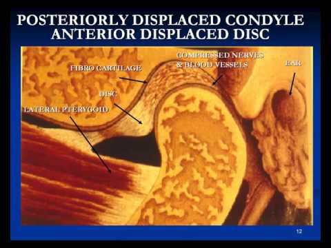 Introduction to Diagnosis and Treatment of TM Dysfunction