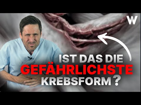 Bauchspeicheldrüsenkrebs: Wichtige Anzeichen! Früherkennung & Therapie bei Diagnose Pankreaskarzinom