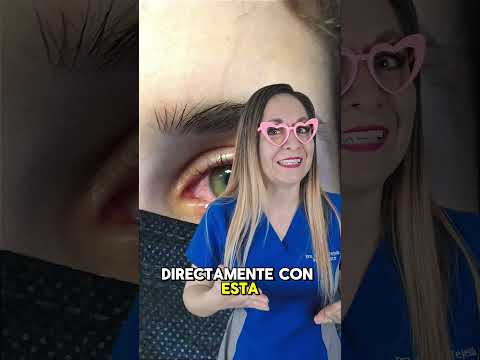 Are red eyes caused by diabetes? 😎😥/Dr. Melissa Tejeida