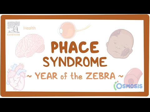 PHACE Syndrome (Year of the Zebra)