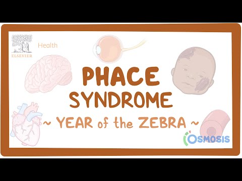 Achalasia Year of the Zebra