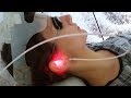 video thumbnail (1)