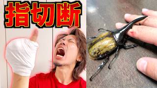 ヘラクレスオオカブトに挟まれて指切断しました