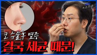 코 수술 후 발생하는 염증, 원인과 해결방법은?