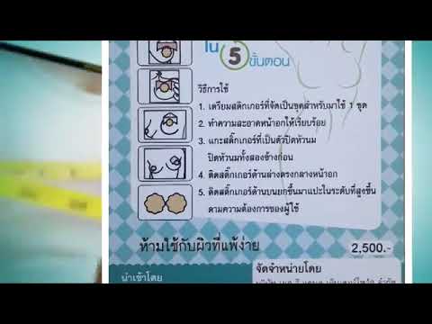 ยามแถวหน้าอกซิลิโคน เลี้ยงลูกด้วยนมน้ำเหลืองขยายโหนด