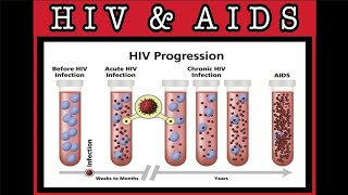 HIV AND AIDS- Signs,Symptoms,Transmission route/rate,Life cycle -pathology, management| Quick review