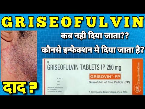Griseofulvin 500 Mg Tablets, Packaging Type: Stripe
