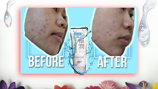 FACIALWASH yg bagus untuk kulitkering | SABUN MUKA yg bikin muka kenyal kayak bayi | HADALABO REVIEW