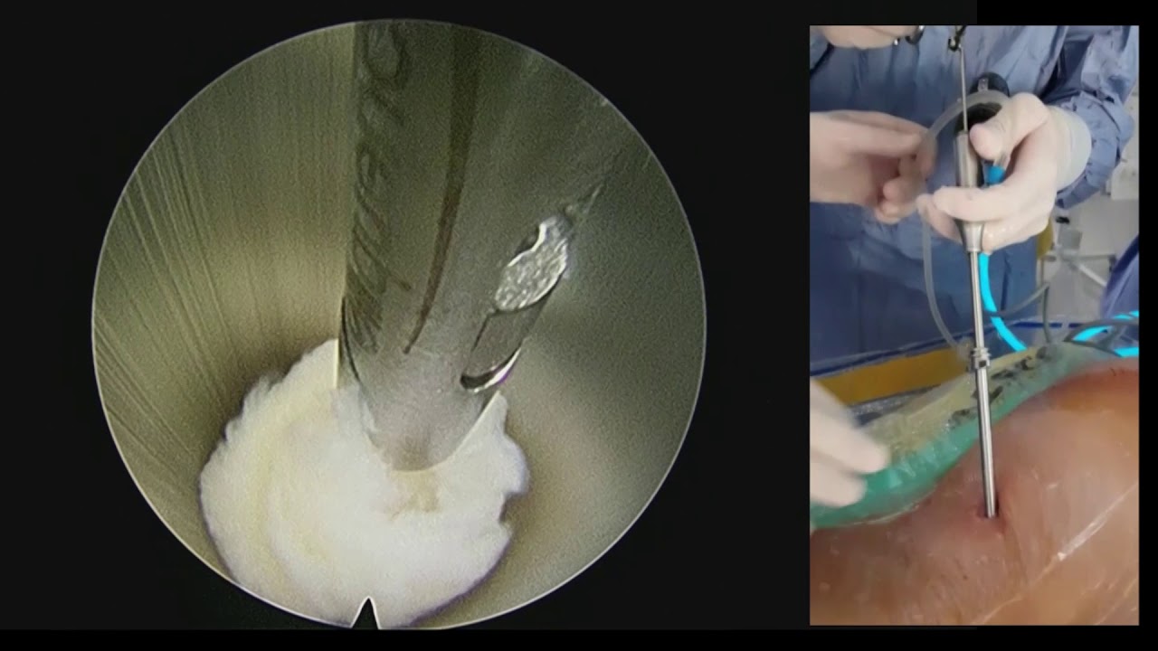 Federico Caporlingua-5