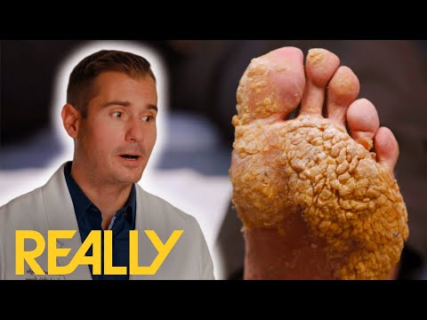 “Top 3 Most Perplexing Cases Ever” Doctor Shocked | My Feet Are Killing Me