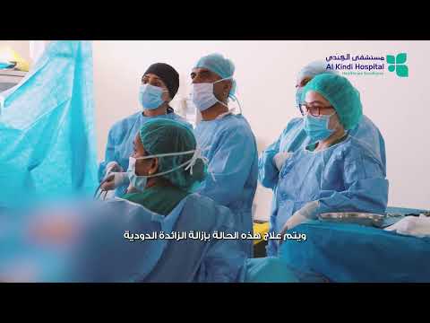 Laparoscopic Appendectomy