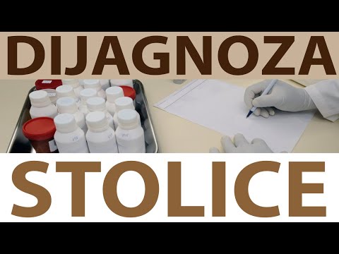 Vrste stolica Veličina, oblik i boja Dr#19