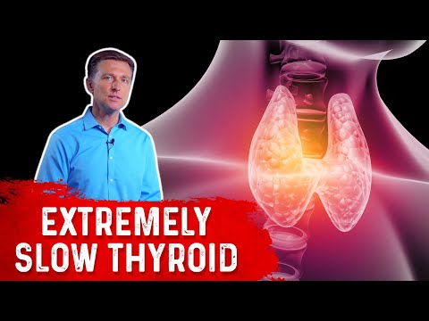Hyperthyroid vs Hypothyroid Explained By Dr Berg
