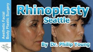Dr. Philip Young