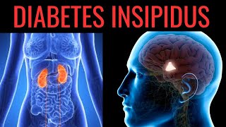 What is Diabetes Insipidus? Symptoms, Causes, Treatment