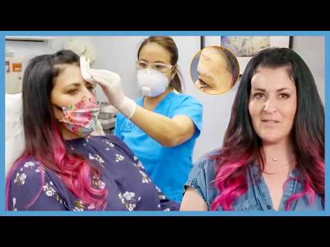 Cyst Popper Videos