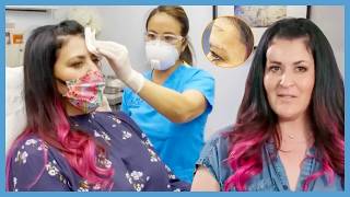 15-Year Head Bump Finally Removed By Dr Lee | Dr Pimple Popper