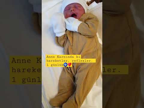 1 GÜNLÜK GÜZEL BEBEĞİMİZ ▶️ ANNE KARNINDA Kİ REFLEX VE HAREKETLER😇💞