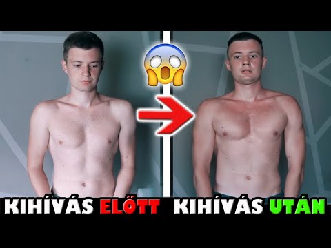 Eszem és nem hízok el talán férgek a férgek hasmenést okozhatnak