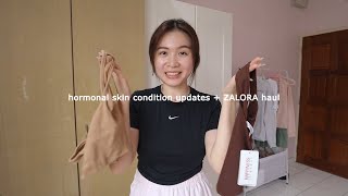 hormonal skin condition updates + zalora haul